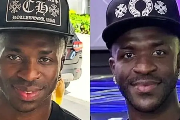 Vinicius, his face disfigured by the operation: here he is before and after | Libero Quotidiano.it