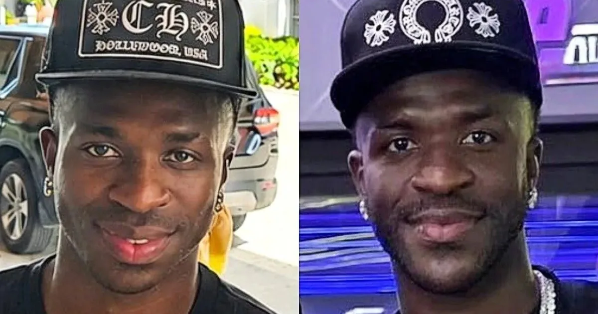 Vinicius, his face disfigured by the operation: here he is before and after | Libero Quotidiano.it